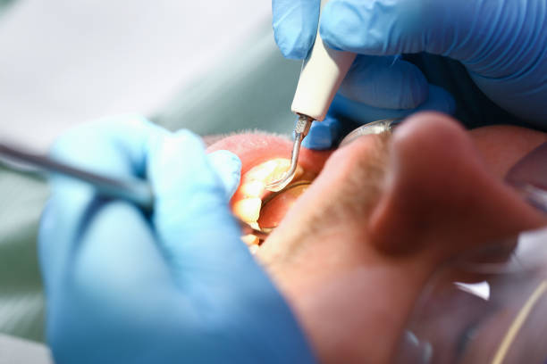 Best Emergency Treatment for Oral Infections in Mitchellville, IA