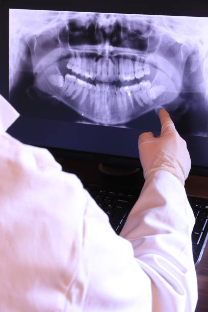 Best Knocked-Out Tooth (Avulsed Tooth) Treatment in Mitchellville, IA