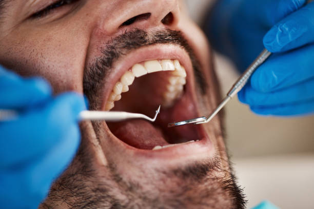 Best Emergency Care for Gum Disease in Mitchellville, IA